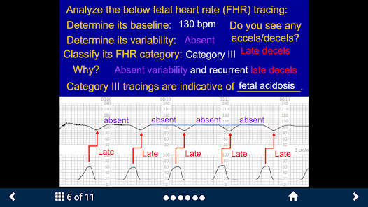 Fetal Heart Rate - SecondLook screenshot 15 of 15
