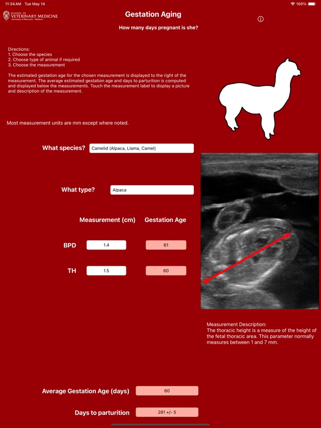 Gestation Aging screenshot 4 of 6
