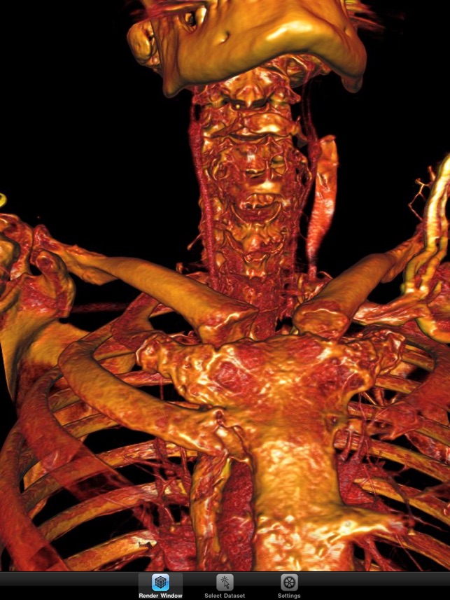 ImageVis3D Mobile Universal screenshot 2 of 9