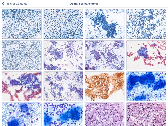 Johns Hopkins Atlas of Pancreatic Cytopathology screenshot 2 of 5