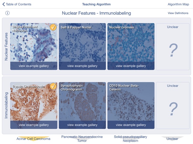 Johns Hopkins Atlas of Pancreatic Cytopathology screenshot 4 of 5