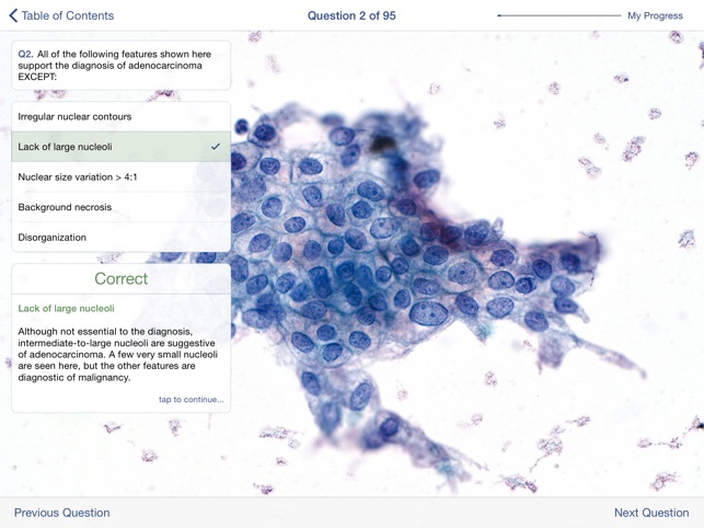Johns Hopkins Atlas of Pancreatic Cytopathology screenshot 5 of 5