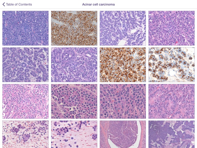 Johns Hopkins Atlas of Pancreatic Pathology screenshot 2 of 5