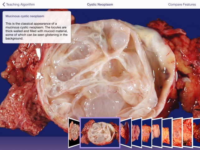 Johns Hopkins Atlas of Pancreatic Pathology screenshot 3 of 5