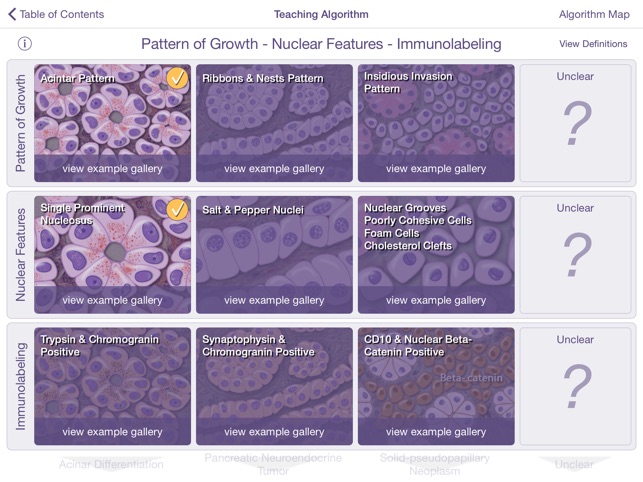 Johns Hopkins Atlas of Pancreatic Pathology screenshot 4 of 5