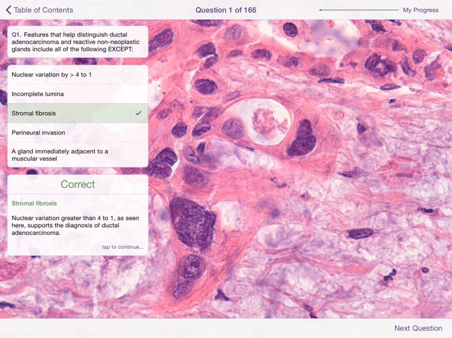 Johns Hopkins Atlas of Pancreatic Pathology screenshot 5 of 5