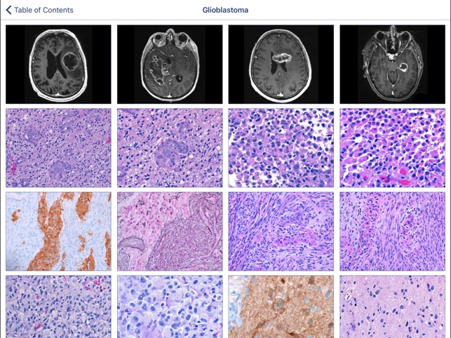 Johns Hopkins Atlas of Surgical Neuropathology screenshot 2 of 5