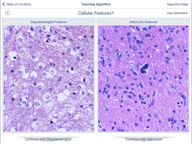 Johns Hopkins Atlas of Surgical Neuropathology screenshot 3 of 5