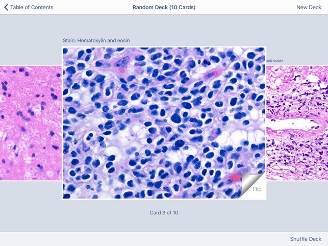 Johns Hopkins Atlas of Surgical Neuropathology screenshot 5 of 5