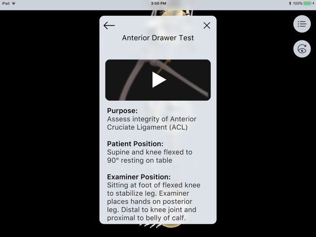 LE Special Tests Pro Consult screenshot 3 of 9