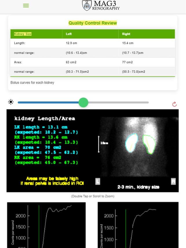MAG3Renography screenshot 4 of 24