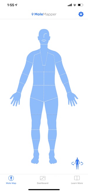 Mole Mapper Melanoma Study screenshot 2 of 8