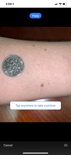 Mole Mapper Melanoma Study screenshot 3 of 8