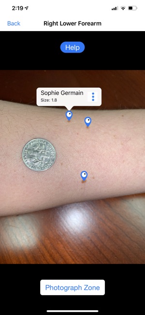 Mole Mapper Melanoma Study screenshot 5 of 8