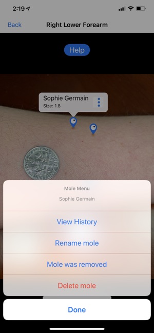 Mole Mapper Melanoma Study screenshot 6 of 8