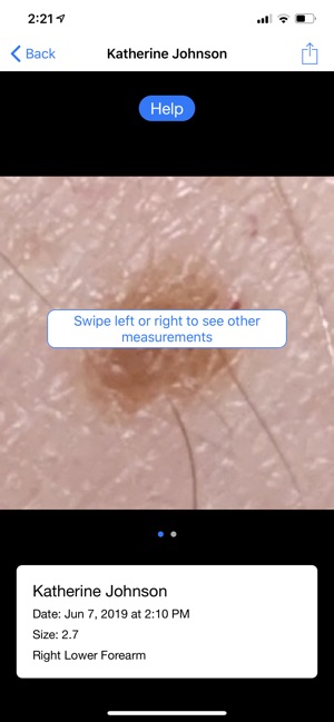 Mole Mapper Melanoma Study screenshot 7 of 8