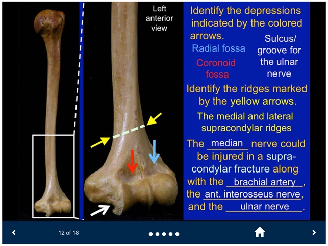 MSK Anatomy - SecondLook screenshot 2 of 10