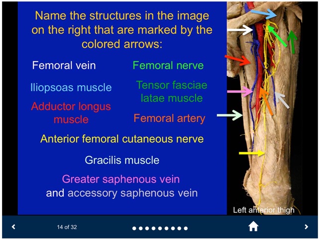 MSK Anatomy - SecondLook screenshot 4 of 10
