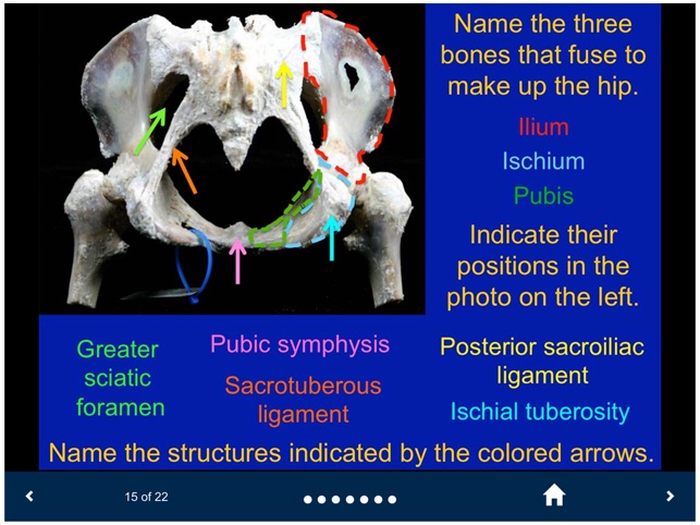 MSK Anatomy - SecondLook screenshot 5 of 10