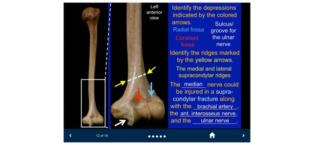 MSK Anatomy - SecondLook screenshot 7 of 10