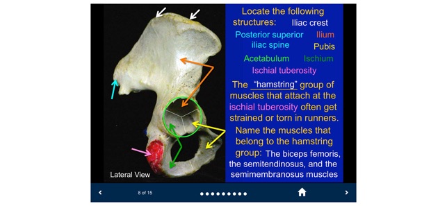 MSK Anatomy - SecondLook screenshot 8 of 10