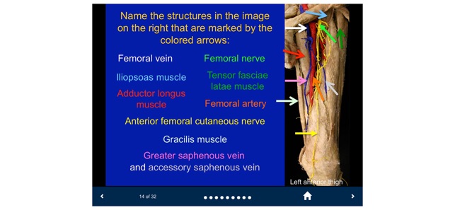 MSK Anatomy - SecondLook screenshot 9 of 10
