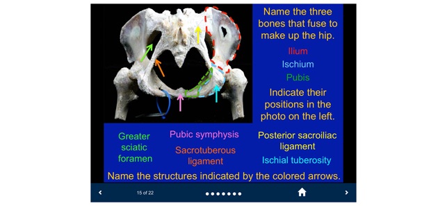 MSK Anatomy - SecondLook screenshot 10 of 10