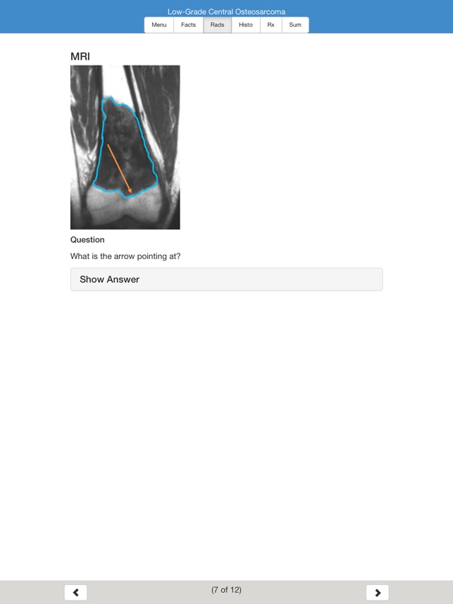 MSK Oncology Educational Atlas screenshot 2 of 10