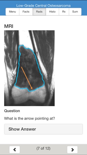 MSK Oncology Educational Atlas screenshot 7 of 10