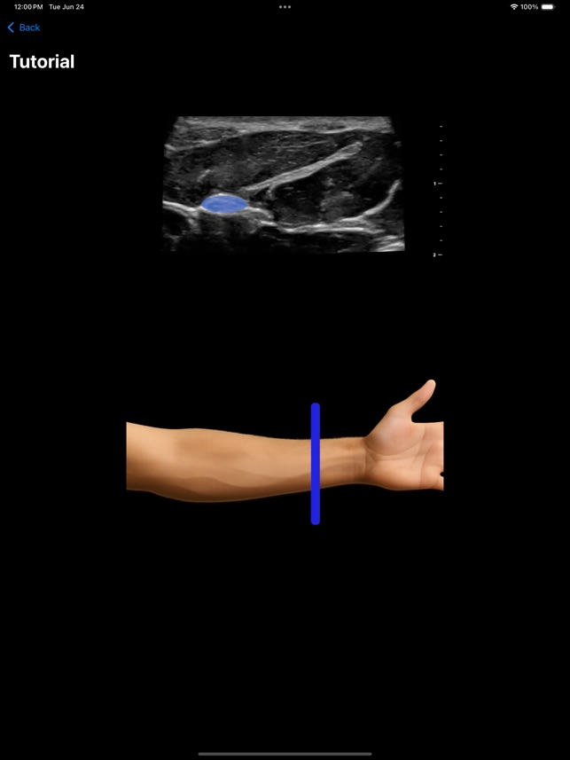 MSK VUE screenshot 2 of 12