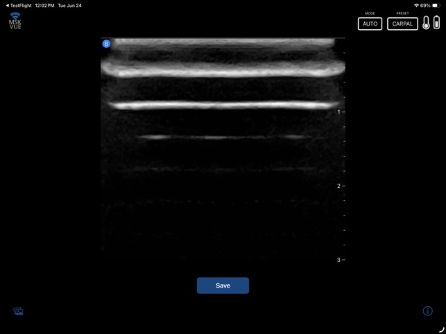 MSK VUE screenshot 3 of 12