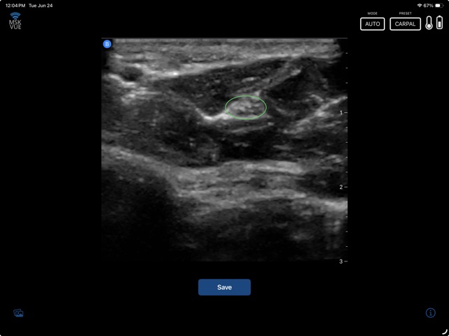 MSK VUE screenshot 6 of 12