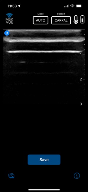 MSK VUE screenshot 7 of 12