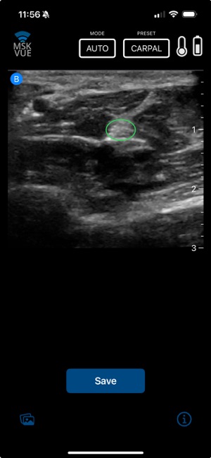 MSK VUE screenshot 8 of 12