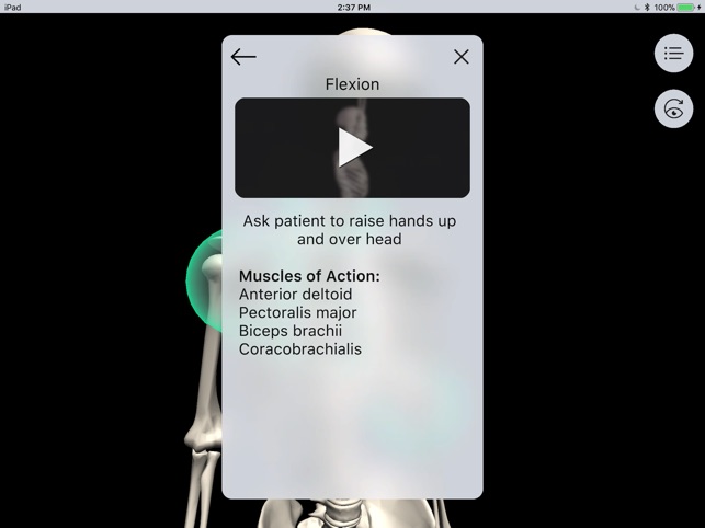 Musculoskeletal Pro Consult screenshot 3 of 10