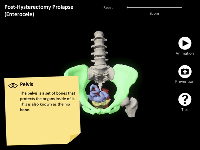 myProlapse screenshot 2 of 2