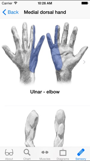 Nerve Whiz screenshot 1 of 5