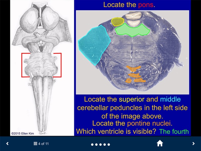 Neuroanatomy - SecondLook screenshot 5 of 10