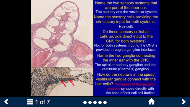 Neuroanatomy - SecondLook screenshot 8 of 10