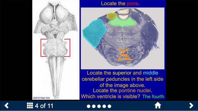 Neuroanatomy - SecondLook screenshot 10 of 10