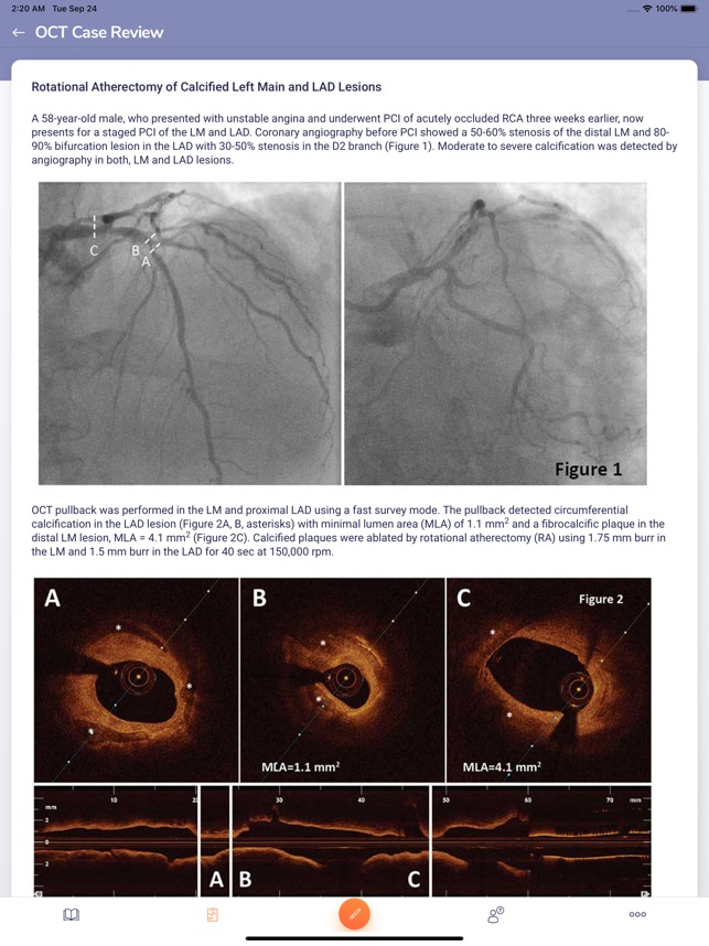 OCTAID screenshot 2 of 14
