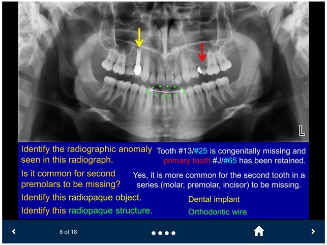 Oral Radiology - SecondLook screenshot 2 of 25