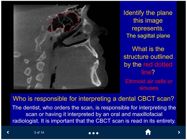 Oral Radiology - SecondLook screenshot 5 of 25