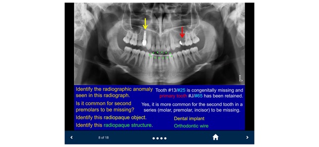 Oral Radiology - SecondLook screenshot 7 of 25
