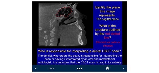 Oral Radiology - SecondLook screenshot 10 of 25