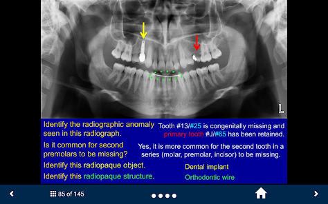 Oral Radiology - SecondLook screenshot 12 of 25
