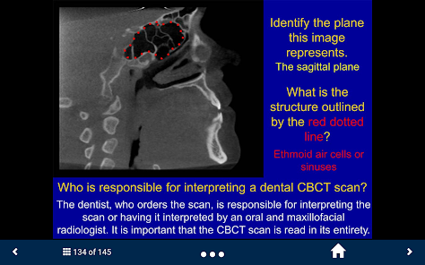 Oral Radiology - SecondLook screenshot 25 of 25