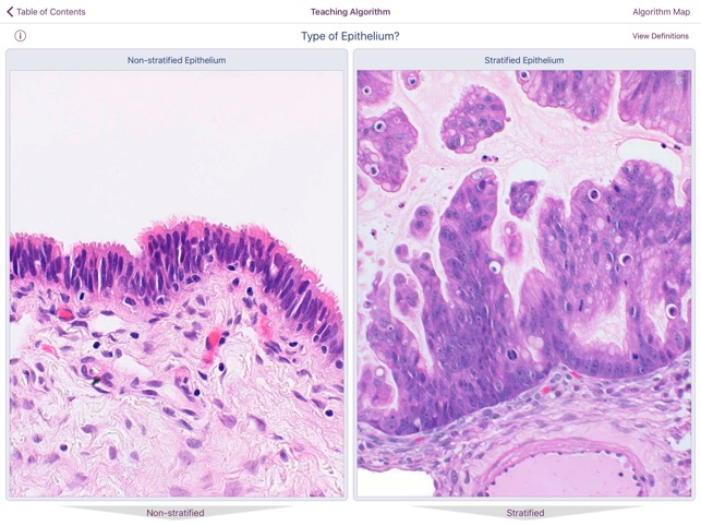 Ovarian Tumor Pathology screenshot 4 of 5