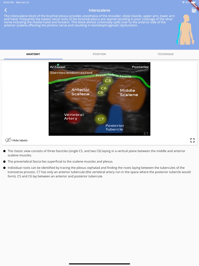 Regional Anesthesia Reference screenshot 1 of 9