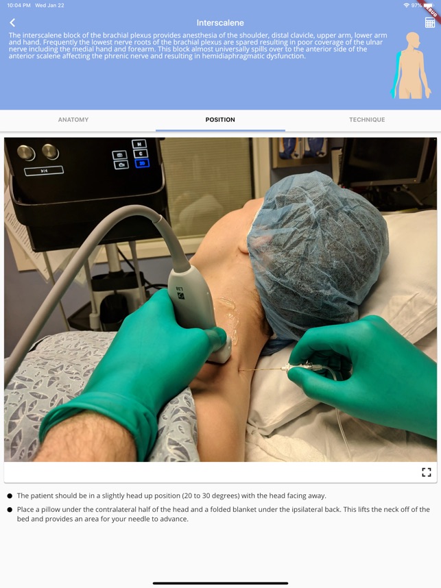 Regional Anesthesia Reference screenshot 4 of 9